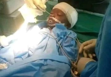 Fais divers : Une femme de 27 ans plante un couteau à la tête de sa nièce de 20 mois